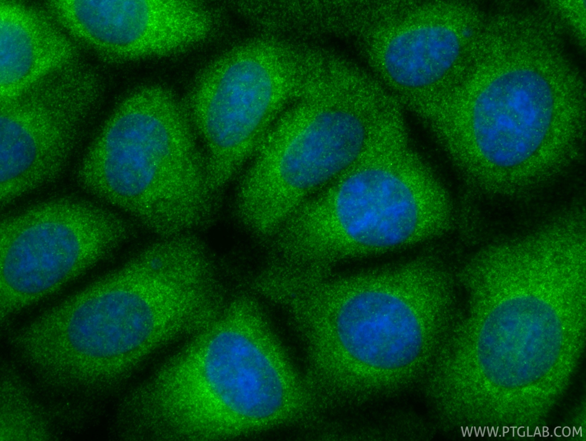 IF Staining of MCF-7 using 13815-1-AP Immunofluorescence (IF) / fluorescent staining of MCF-7 cells using AACS Polyclonal antibody (13815-1-AP)