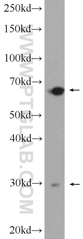 Western Blot (WB) analysis of mouse liver tissue using AACS Polyclonal antibody (13815-1-AP)