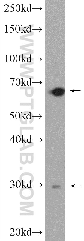 WB analysis of mouse liver using 13815-1-AP