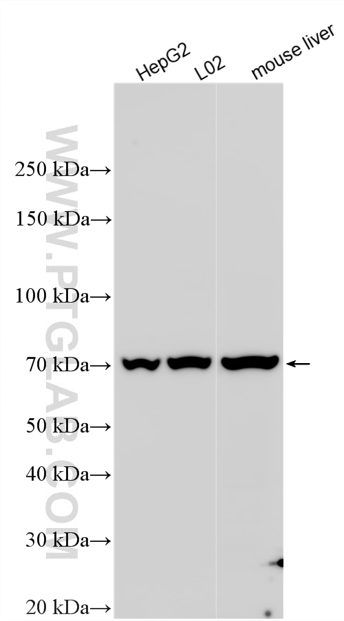 WB analysis using 13815-1-AP Western Blot (WB) analysis of various lysates using AACS Polyclonal antibody (13815-1-AP)