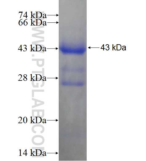 AACS fusion protein Ag4740 SDS-PAGE