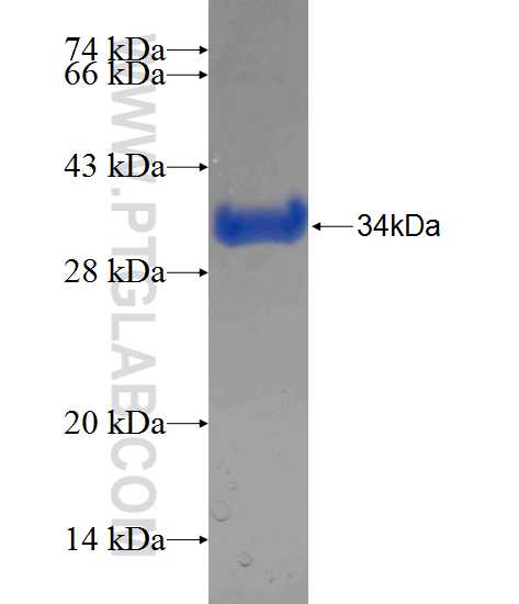 AADAC fusion protein Ag24377 SDS-PAGE