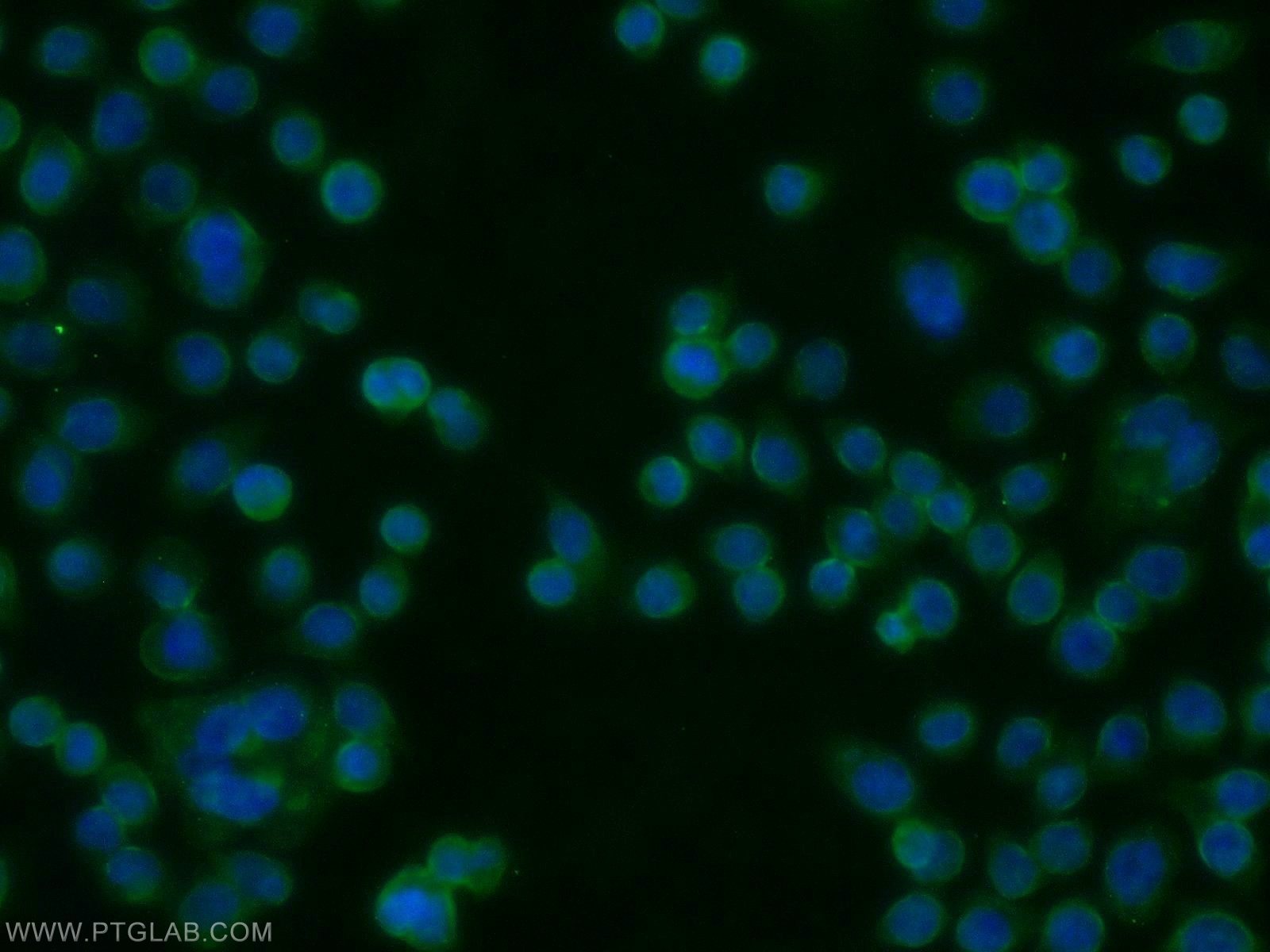 Immunofluorescence (IF) / fluorescent staining of COLO 320 cells using AADACL1 Polyclonal antibody (14021-1-AP)