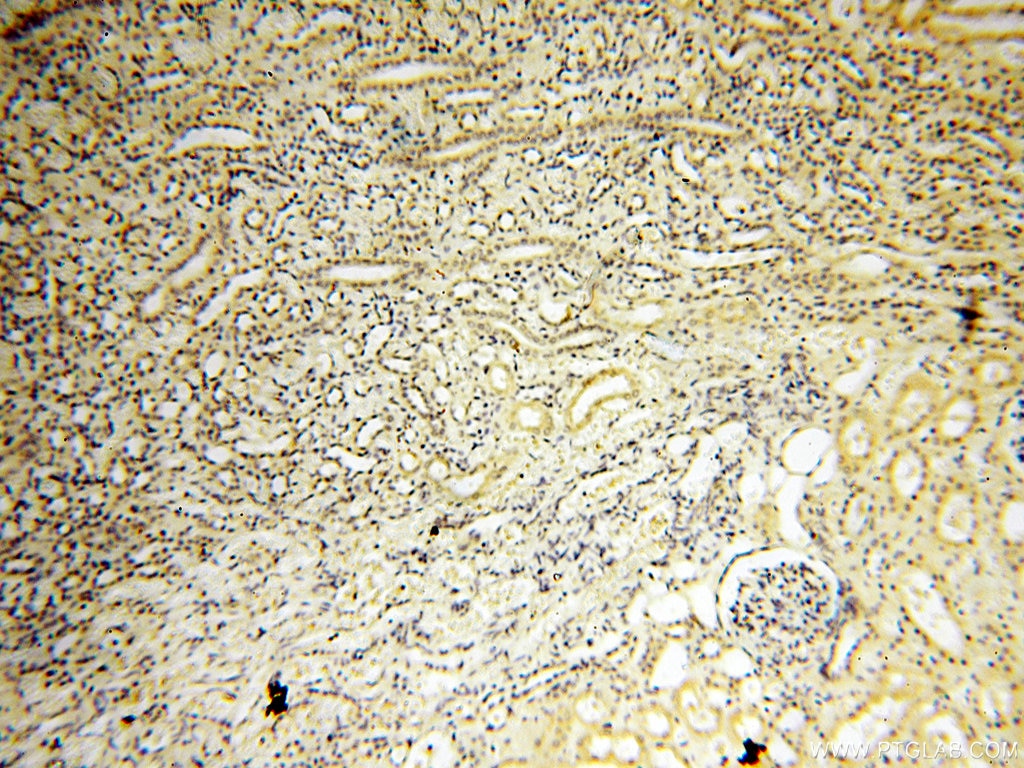 Immunohistochemistry (IHC) staining of human kidney tissue using AADACL1 Polyclonal antibody (14021-1-AP)