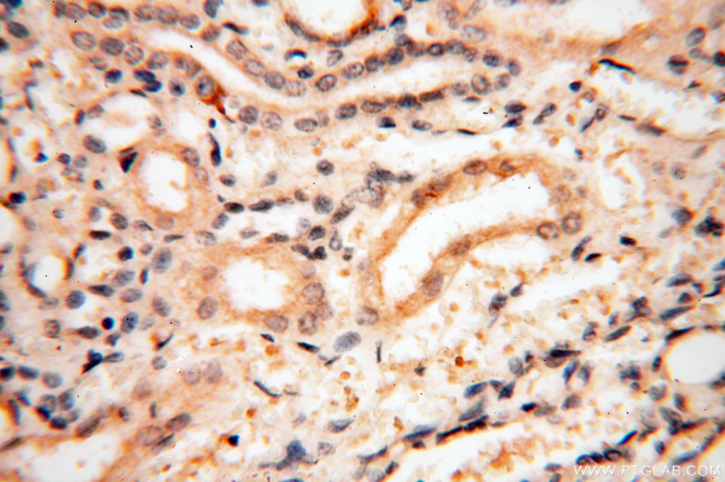 Immunohistochemistry (IHC) staining of human kidney tissue using AADACL1 Polyclonal antibody (14021-1-AP)
