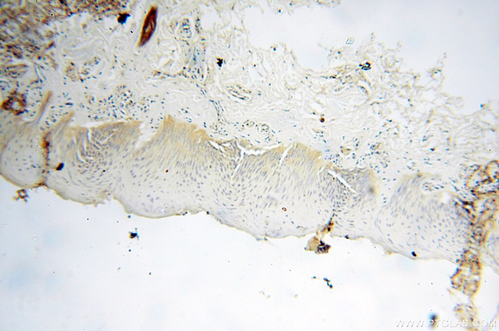 Immunohistochemistry (IHC) staining of human skin tissue using AADACL1 Polyclonal antibody (14021-1-AP)