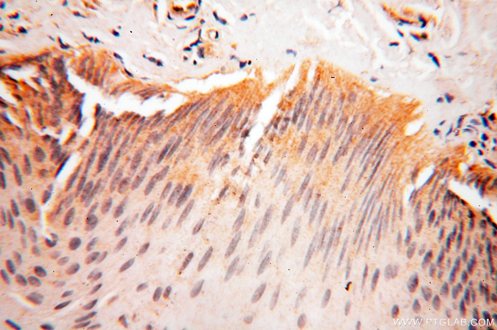 Immunohistochemistry (IHC) staining of human skin tissue using AADACL1 Polyclonal antibody (14021-1-AP)