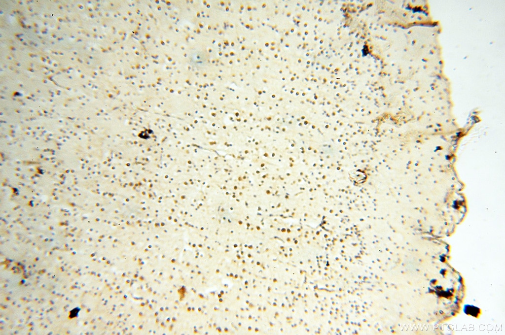 Immunohistochemistry (IHC) staining of human brain tissue using AADACL1 Polyclonal antibody (14021-1-AP)