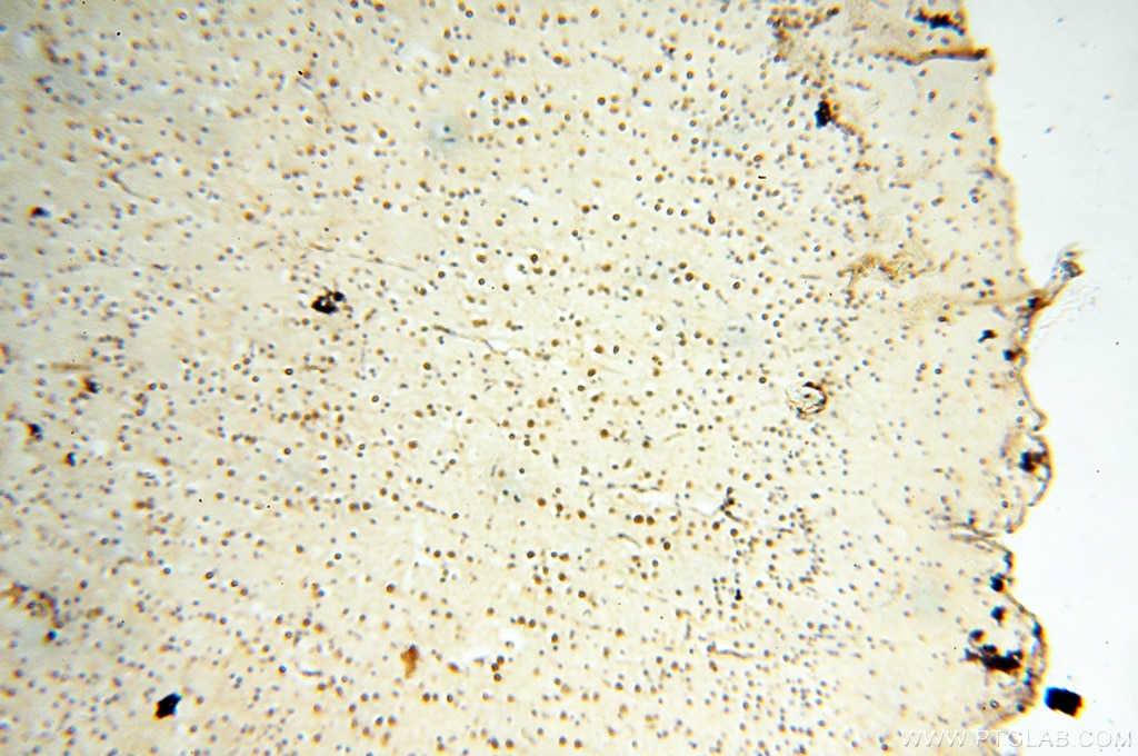 Immunohistochemistry (IHC) staining of human brain tissue using AADACL1 Polyclonal antibody (14021-1-AP)