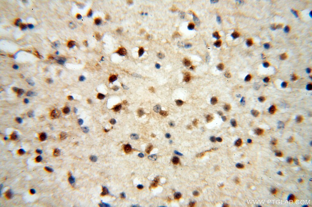 Immunohistochemistry (IHC) staining of human brain tissue using AADACL1 Polyclonal antibody (14021-1-AP)