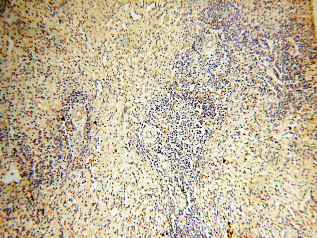 Immunohistochemistry (IHC) staining of human spleen tissue using AADACL1 Polyclonal antibody (14021-1-AP)