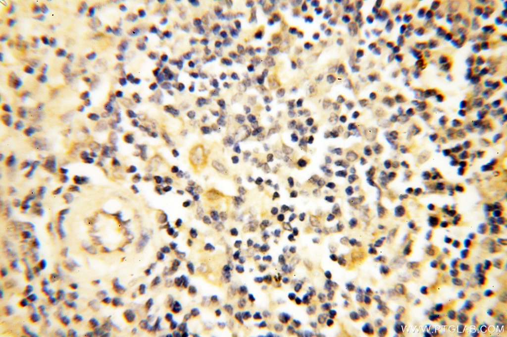 Immunohistochemistry (IHC) staining of human spleen tissue using AADACL1 Polyclonal antibody (14021-1-AP)