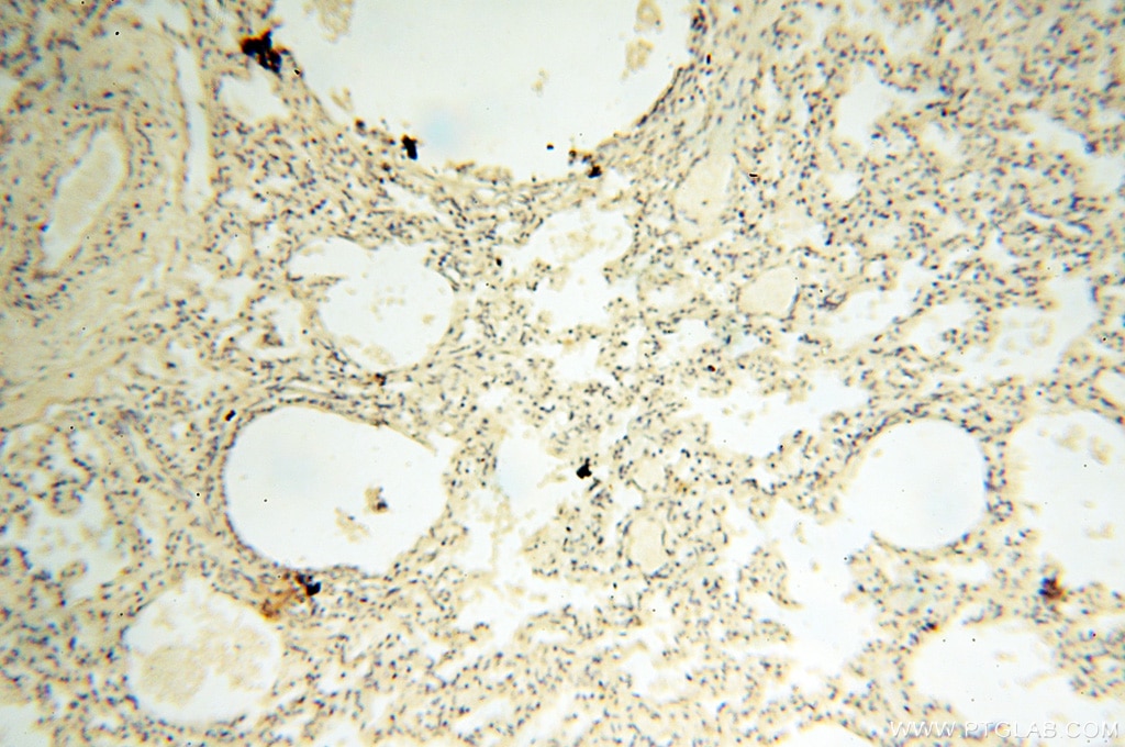 Immunohistochemistry (IHC) staining of human lung tissue using AADACL1 Polyclonal antibody (14021-1-AP)