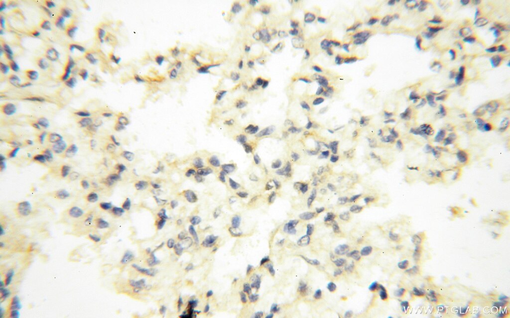 Immunohistochemistry (IHC) staining of human lung tissue using AADACL1 Polyclonal antibody (14021-1-AP)