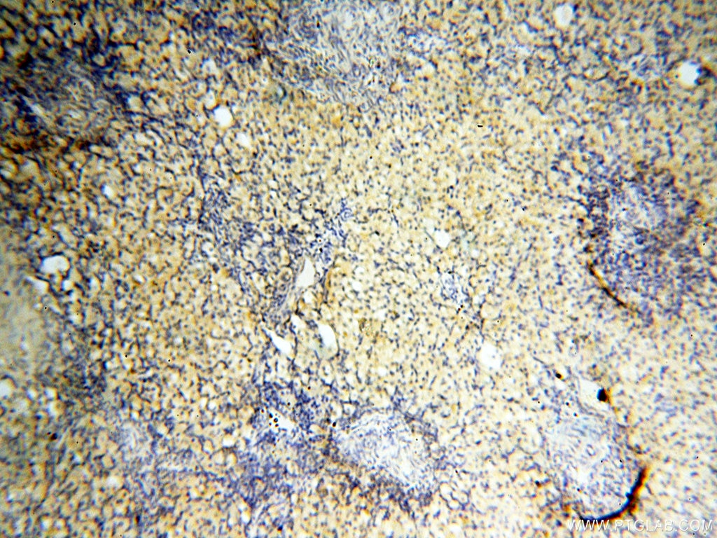 Immunohistochemistry (IHC) staining of human ovary tissue using AADACL1 Polyclonal antibody (14021-1-AP)