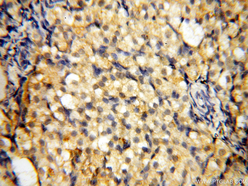 Immunohistochemistry (IHC) staining of human ovary tissue using AADACL1 Polyclonal antibody (14021-1-AP)