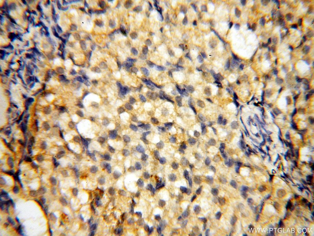 IHC staining of human ovary using 14021-1-AP