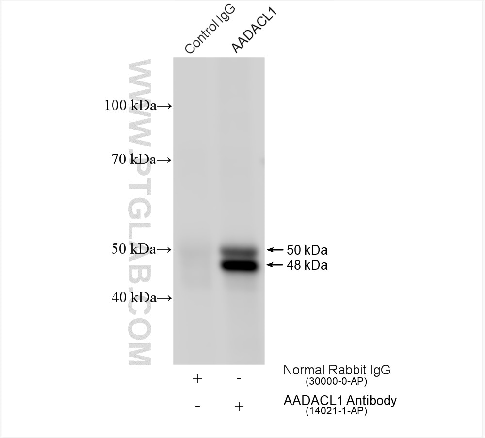 Immunoprecipitation (IP) experiment of COLO 320 cells using AADACL1 Polyclonal antibody (14021-1-AP)