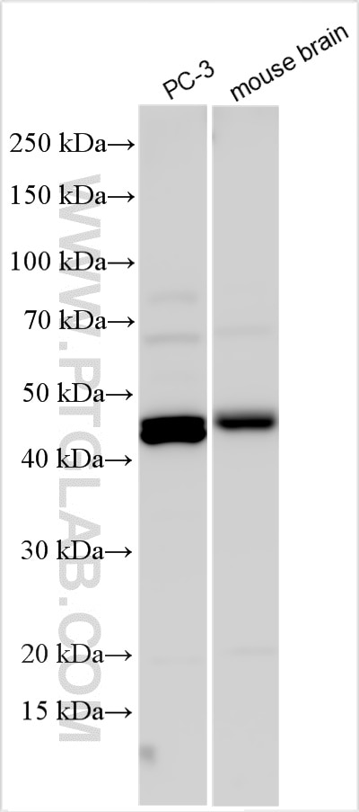 Western Blot (WB) analysis of various lysates using AADACL1 Polyclonal antibody (14021-1-AP)