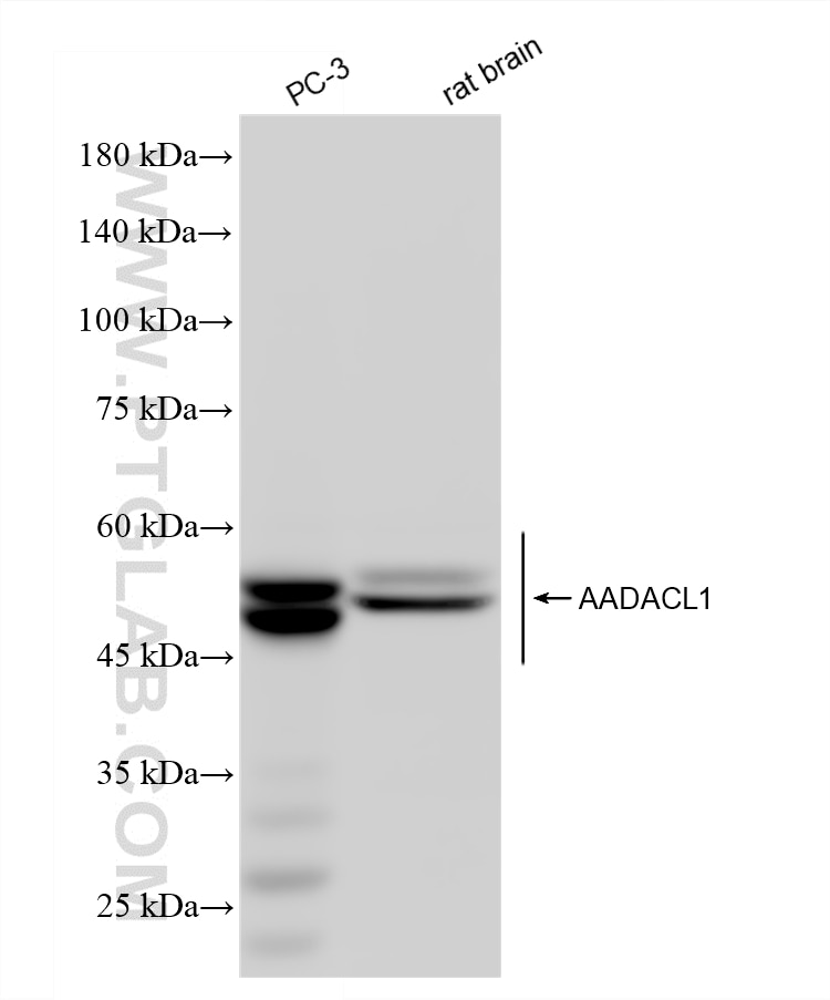 Western Blot (WB) analysis of various lysates using AADACL1 Recombinant monoclonal antibody (87679-2-RR)