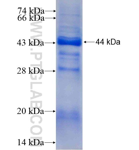 AADACL1 fusion protein Ag5136 SDS-PAGE