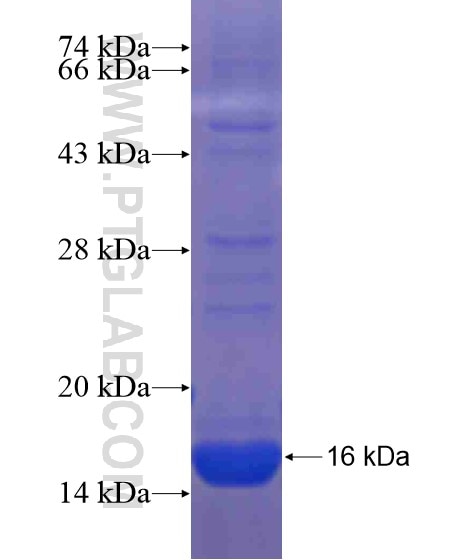 AADACL2 fusion protein Ag20955 SDS-PAGE