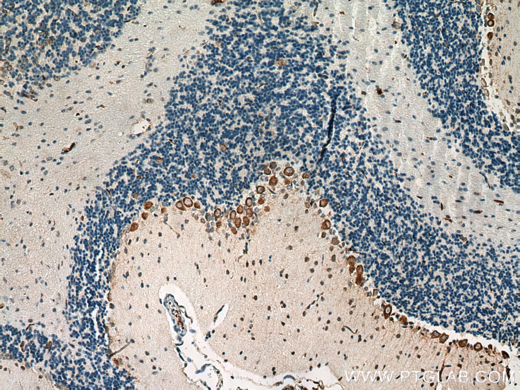 Immunohistochemistry (IHC) staining of mouse cerebellum tissue using AADAT Polyclonal antibody (13031-1-AP)