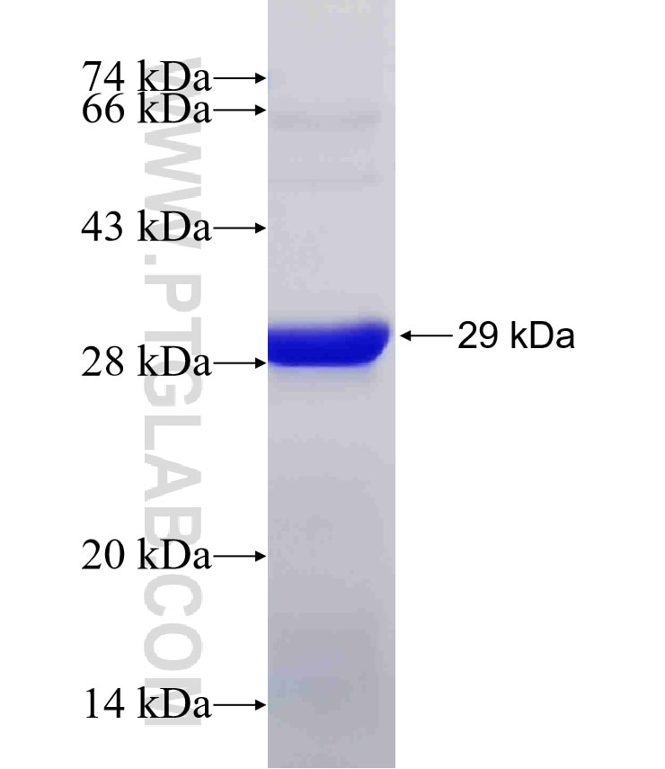 AAK1 fusion protein Ag7496 SDS-PAGE
