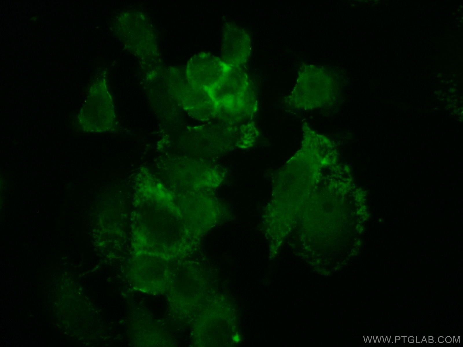 Immunofluorescence (IF) / fluorescent staining of MCF-7 cells using AAMP Polyclonal antibody (21220-1-AP)