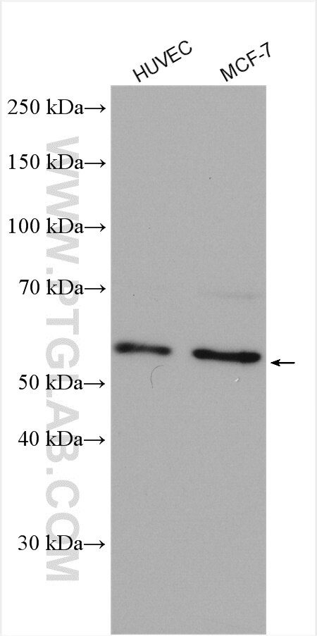 Western Blot (WB) analysis of various lysates using AAMP Polyclonal antibody (21220-1-AP)