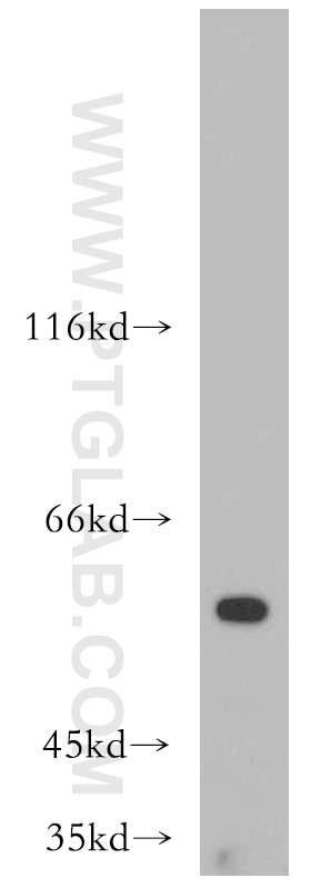 Western Blot (WB) analysis of human heart tissue using AAMP Polyclonal antibody (21220-1-AP)