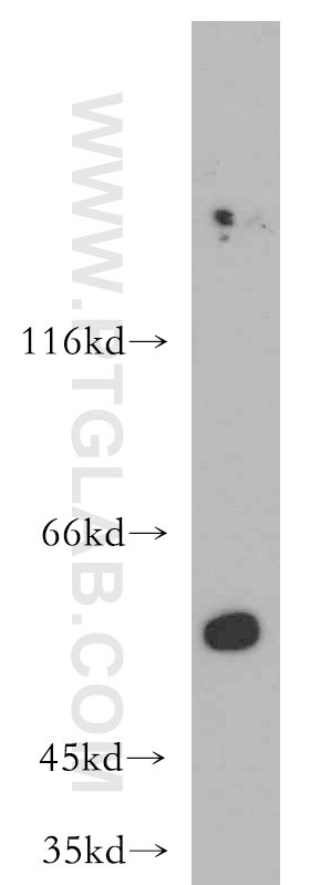 Western Blot (WB) analysis of mouse kidney tissue using AAMP Polyclonal antibody (21220-1-AP)