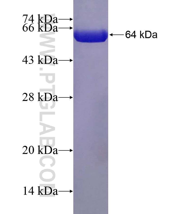 AAMP fusion protein Ag15655 SDS-PAGE