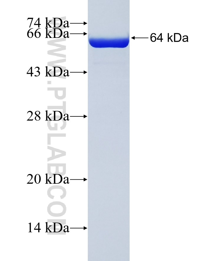 AAMP fusion protein Ag15655 SDS-PAGE