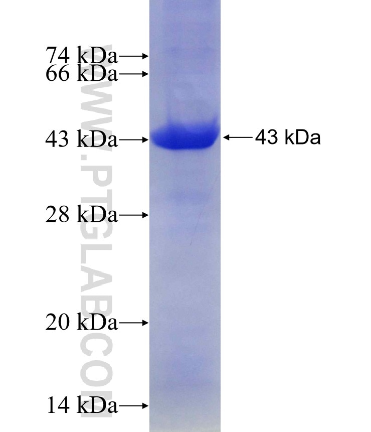 AAMP fusion protein Ag15861 SDS-PAGE
