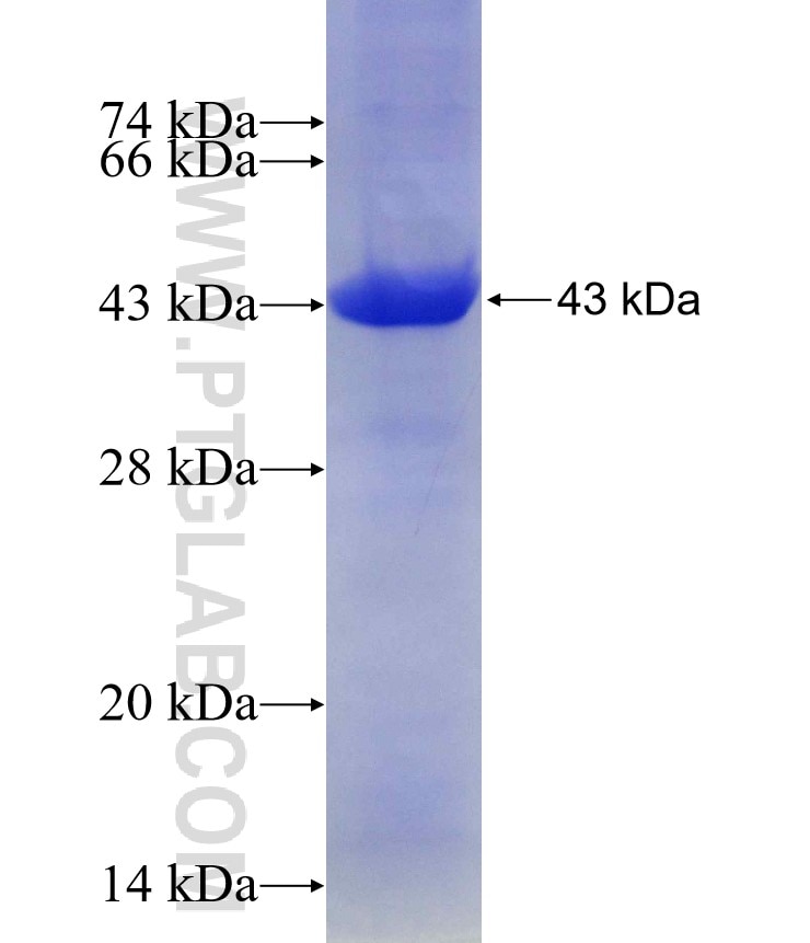 AAMP fusion protein Ag15861 SDS-PAGE