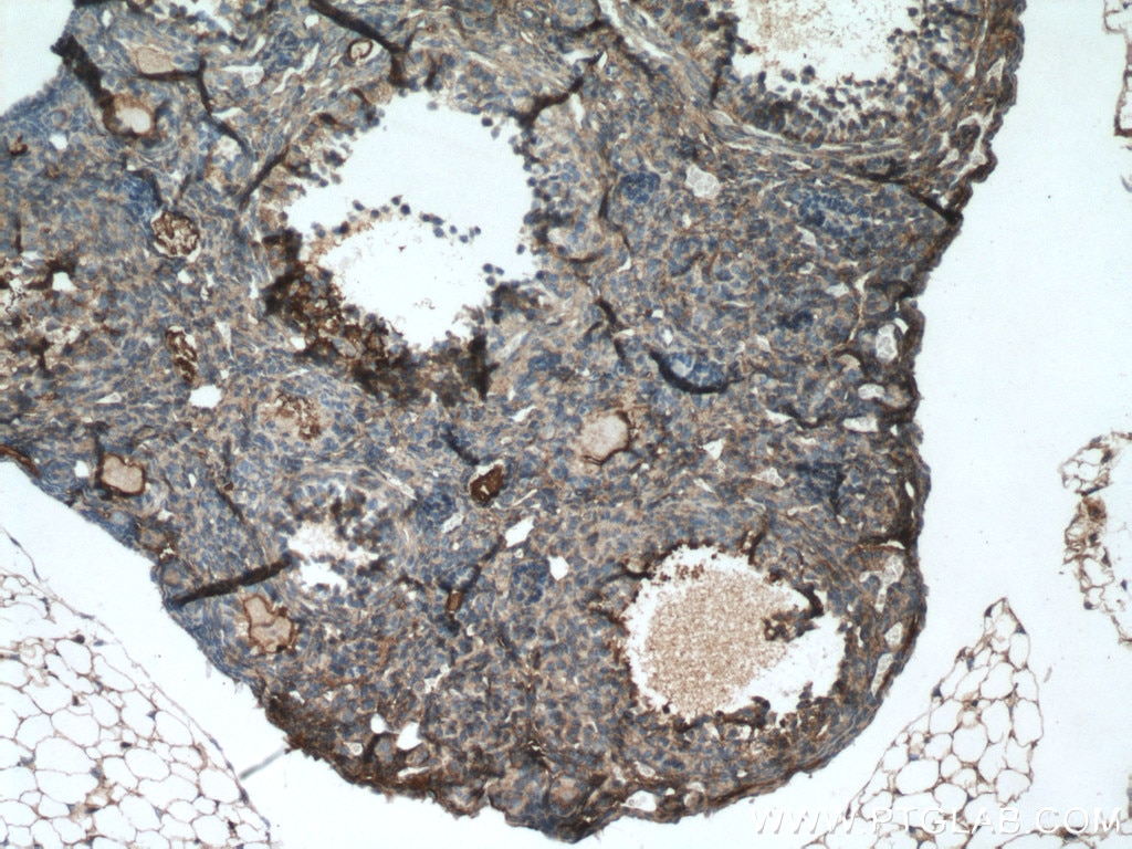 Immunohistochemistry (IHC) staining of mouse ovary tissue using AANAT Polyclonal antibody (17990-1-AP)