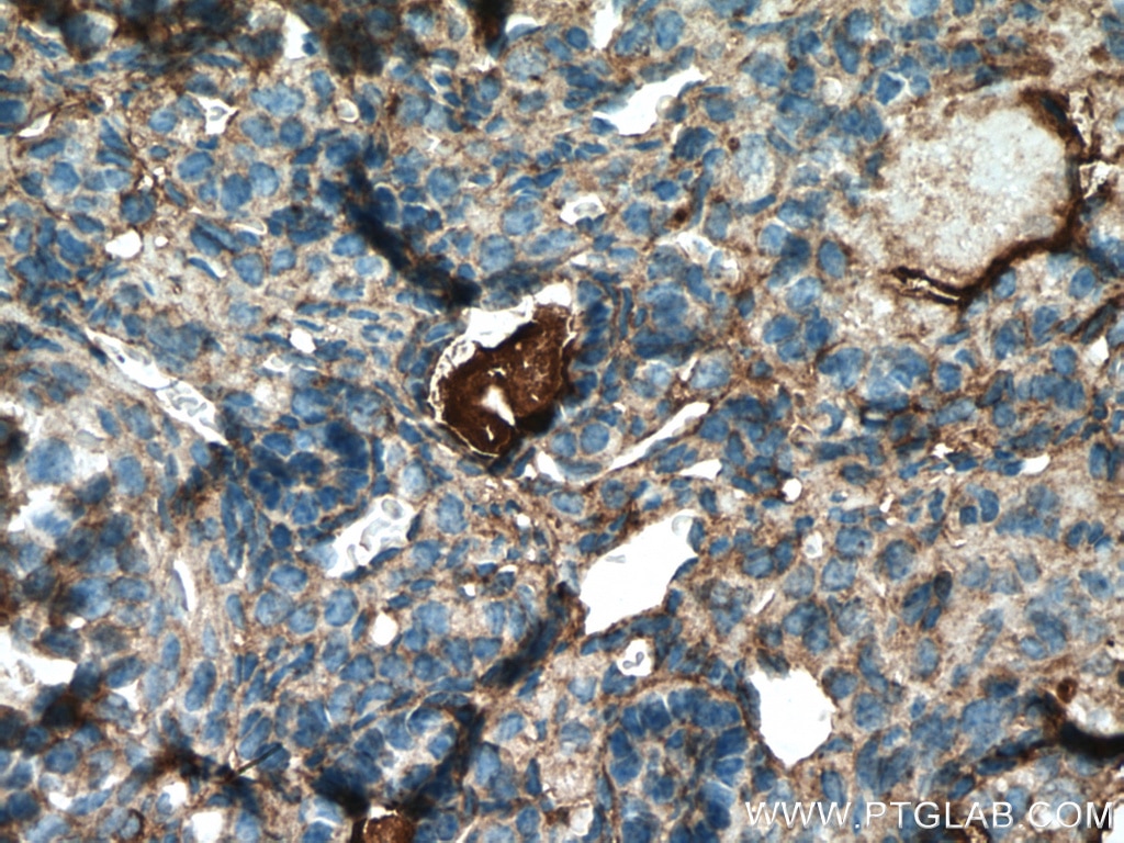 Immunohistochemistry (IHC) staining of mouse ovary tissue using AANAT Polyclonal antibody (17990-1-AP)