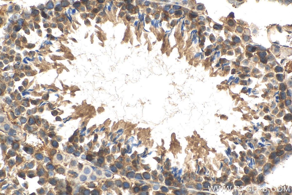 Immunohistochemistry (IHC) staining of mouse testis tissue using AANAT Polyclonal antibody (17990-1-AP)