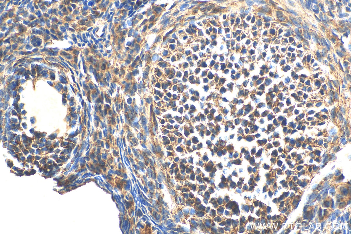Immunohistochemistry (IHC) staining of mouse ovary tissue using AANAT Polyclonal antibody (17990-1-AP)
