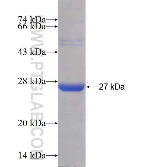 AANAT fusion protein Ag12429 SDS-PAGE