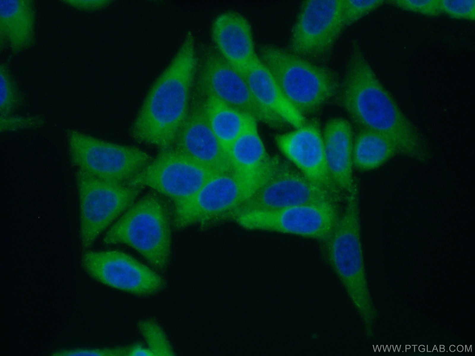 Immunofluorescence (IF) / fluorescent staining of HepG2 cells using AlaRS Polyclonal antibody (17394-1-AP)