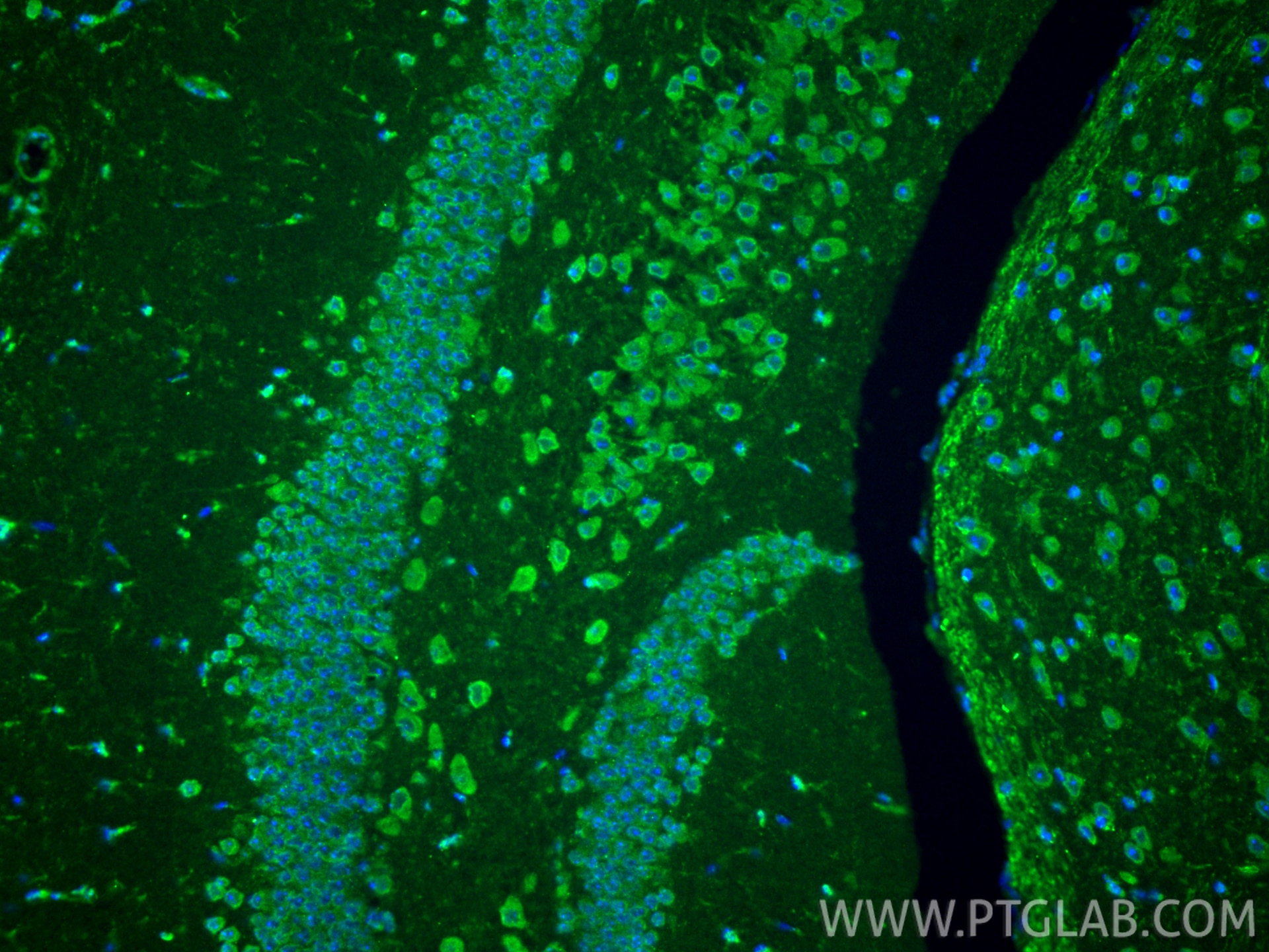 Immunofluorescence (IF) / fluorescent staining of mouse brain tissue using AlaRS Polyclonal antibody (17394-1-AP)