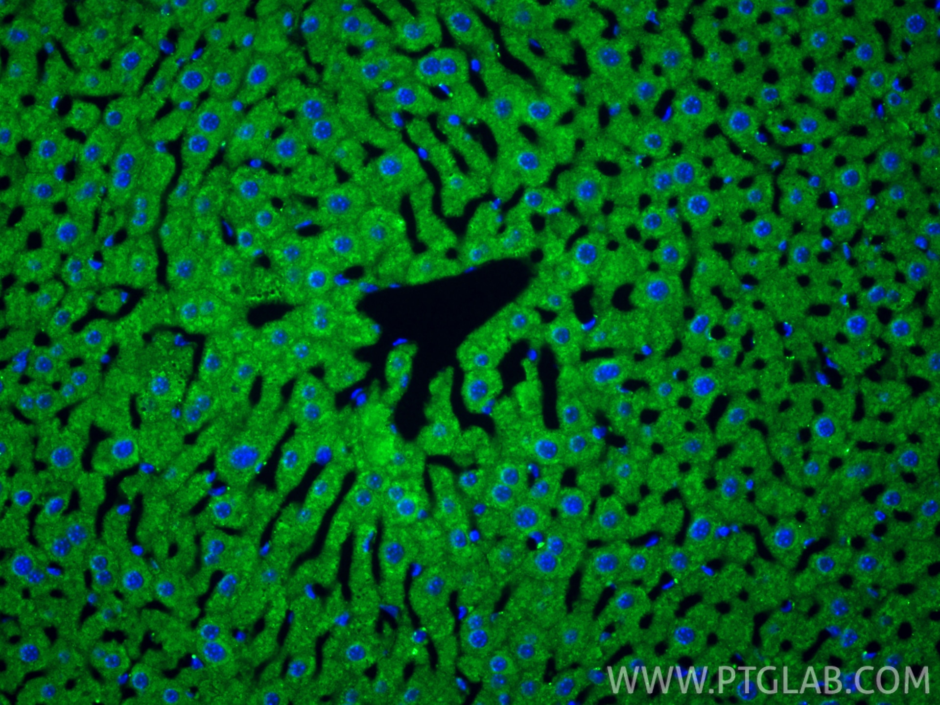Immunofluorescence (IF) / fluorescent staining of mouse liver tissue using AlaRS Polyclonal antibody (17394-1-AP)