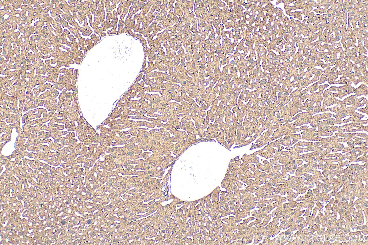 Immunohistochemistry (IHC) staining of mouse liver tissue using AlaRS Polyclonal antibody (17394-1-AP)