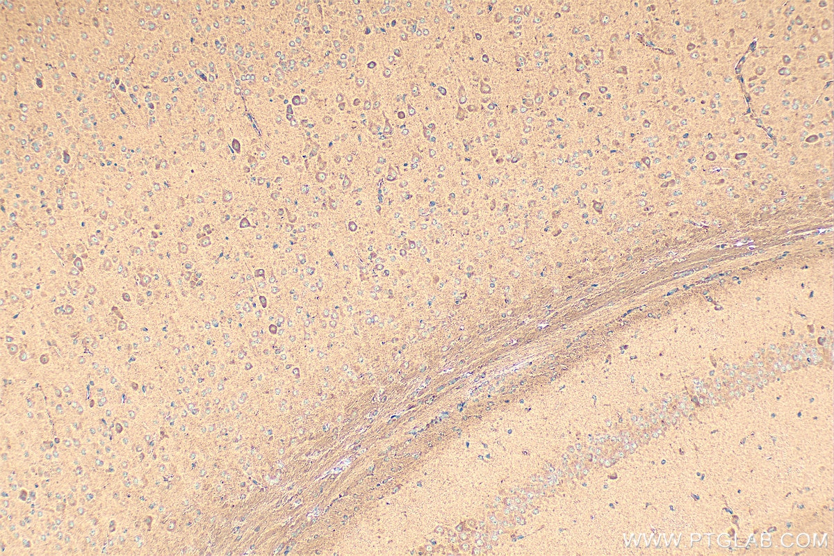 Immunohistochemistry (IHC) staining of mouse brain tissue using AlaRS Polyclonal antibody (17394-1-AP)