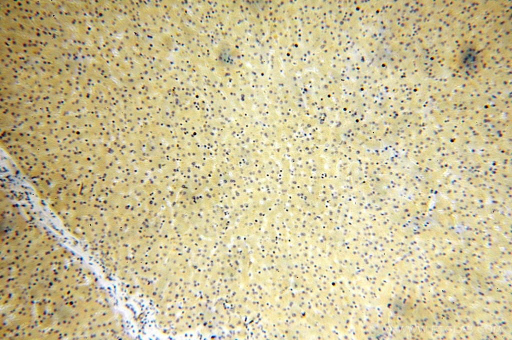 Immunohistochemistry (IHC) staining of human liver tissue using AlaRS Polyclonal antibody (17394-1-AP)