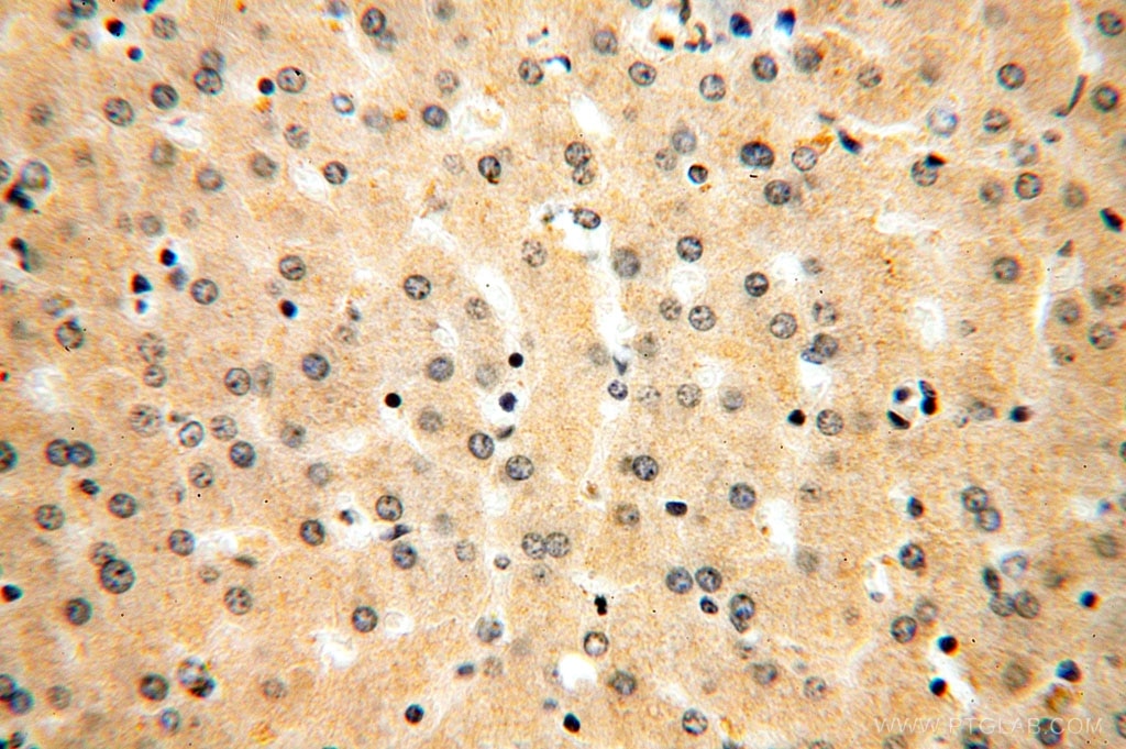 Immunohistochemistry (IHC) staining of human liver tissue using AlaRS Polyclonal antibody (17394-1-AP)