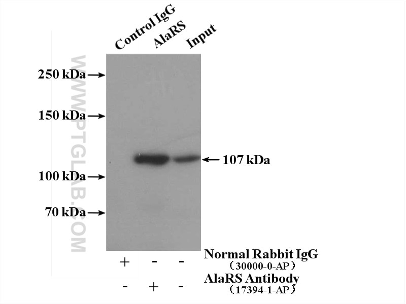 Immunoprecipitation (IP) experiment of HepG2 cells using AlaRS Polyclonal antibody (17394-1-AP)