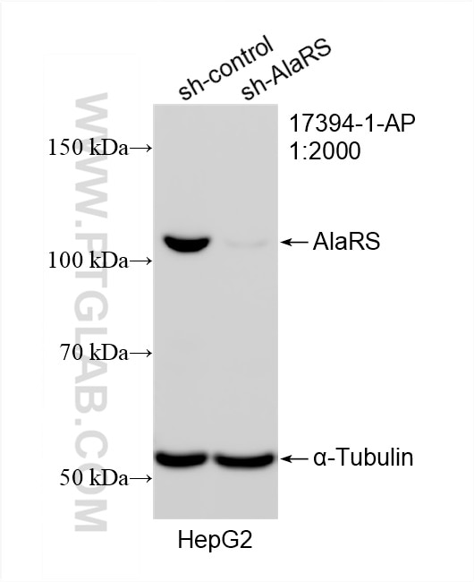 Western Blot (WB) analysis of HepG2 cells using AlaRS Polyclonal antibody (17394-1-AP)